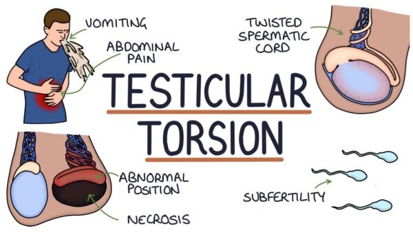 Orion Choco-Pie Chocolate Coated with Marshmallow Filling Cake, 30g Pack of 6 – Wholesale & Export UAE - wholesale supplier | AgroFoods Global