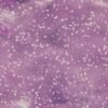Speckled — Bulk & Wholesale Supply 2021 Crop Light Speckled Kidney Beans - wholesale supplier | AgroFoods Global